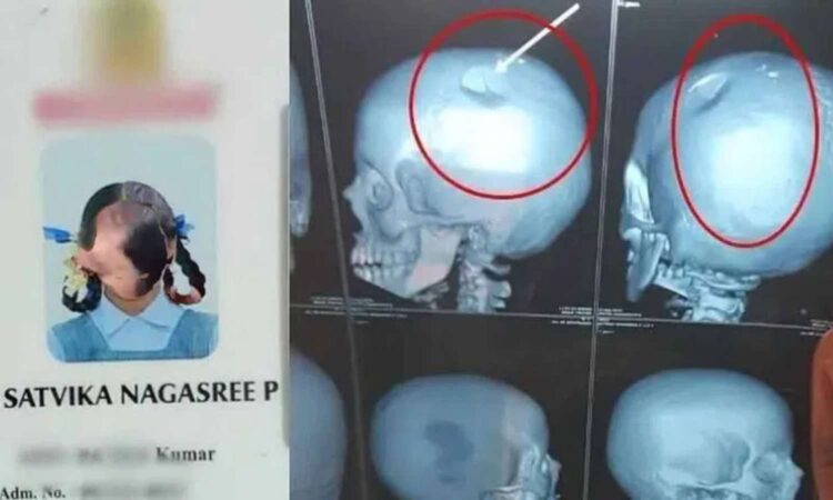 teacher hits girl with school bag